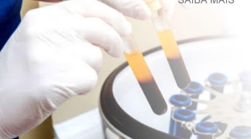 Plasma Rico em Plaquetas – PRP
