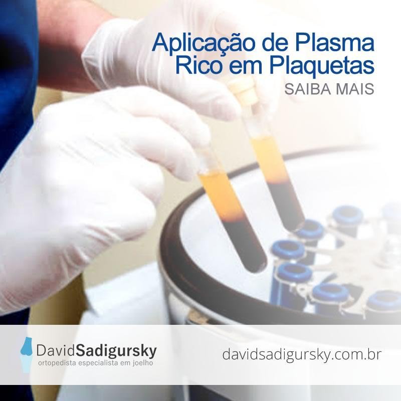 Plasma Rico em Plaquetas – PRP